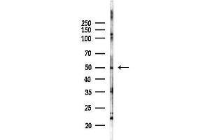 anti-IKAROS Family Zinc Finger 2 (IKZF2) (Internal Region) antibody