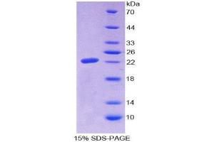 SDS-PAGE (SDS) image for Microfibrillar Associated Protein 2 (MFAP2) (AA 6-162) protein (His tag) (ABIN2125860)
