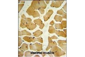 Immunohistochemistry (Paraffin-embedded Sections) (IHC (p)) image for anti-Sphingosine Kinase 1 (SPHK1) (AA 313-343), (C-Term) antibody (ABIN652302)