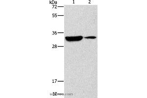Western blot analysis of Mouse heart and brain tissue, using RCAN1 Polyclonal Antibody at dilution of 1:500