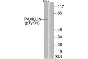 Western blot analysis of extracts from HeLa cells treated with TNF 200ng/ml 2', using Paxillin (Phospho-Tyr31) Antibody.