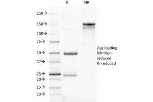 SDS-PAGE Analysis of Purified, BSA-Free TOX3 Antibody (clone TOX3/1123).
