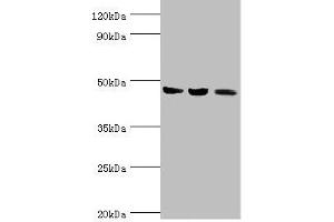 Western blot All lanes: ACAT1 antibody at 6 μg/mL Lane 1: Mouse skeletal musce tissue Lane 2: Rat heart tissue Lane 3: THP-1 whole cell lysate Secondary Goat polyclonal to rabbit IgG at 1/10000 dilution Predicted band size: 46, 18 kDa Observed band size: 46 kDa (ACAT1 Antikörper  (AA 1-145))