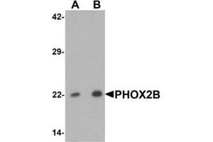 Western blot analysis of PHOX2B in 293 cell lysate with PHOX2B Antibody  at (A) 1 and (B) 2 ug/mL. (PHOX2B Antikörper  (Middle Region))