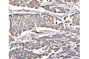 IHC analysis of PMPCA/INPP5 using anti-PMPCA/INPP5 antibody (ABIN7602722). (PMPCA Antikörper  (AA 99-525))