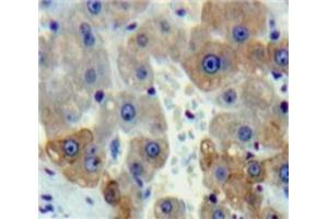 Used in DAB staining on fromalin fixed paraffin-embedded Liver tissue (Peptide YY Antikörper  (AA 30-98))