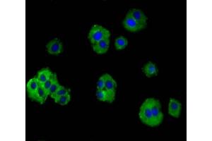 Immunofluorescence staining of HepG2 cells with ABIN7172883 at 1:100, counter-stained with DAPI. (TRPV3 Antikörper  (AA 1-118))