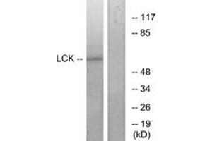 Western blot analysis of extracts from 293 cells, treated with serum 15% 10', using Lck (Ab-393) Antibody. (LCK Antikörper  (AA 361-410))