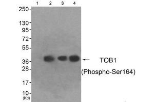 Western blot analysis of extracts from HeLa cells (Lane 2), A549 cells (Lane 3) and HepG2 cells (Lane 4), using TOB1 (Phospho-Ser164) Antibody. (Protein Tob1 (TOB1) (pSer164) Antikörper)