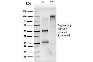 SDS-PAGE Analysis Purified Estrogen Receptor alpha Mouse Monoclonal Antibody (ESR1/3559). (Estrogen Receptor alpha Antikörper  (AA 129-312))