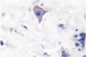 Image no. 2 for anti-Claudin 5 (CLDN5) antibody (ABIN265364) (Claudin 5 Antikörper)