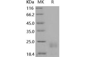 Western Blotting (WB) image for serine Peptidase Inhibitor, Kunitz Type, 2 (SPINT2) protein (His tag) (ABIN7197930)