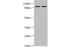 Western blot All lanes: GCC1 antibody at 2 μg/mL Lane 1: Hela whole cell lysate Lane 2: 293T whole cell lysate Secondary Goat polyclonal to rabbit IgG at 1/10000 dilution Predicted band size: 88 kDa Observed band size: 88 kDa (GCC1 Antikörper  (AA 4-775))
