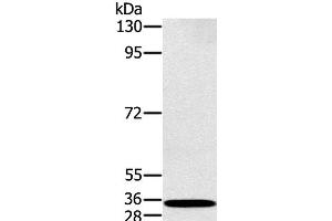 Western Blot analysis of K562 cell using RAB27A Polyclonal Antibody at dilution of 1:400 (RAB27A Antikörper)
