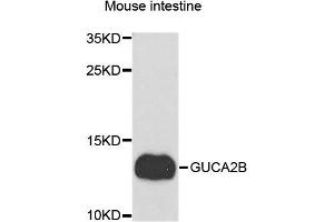 Western blot analysis of extracts of Mouse intestine cells, using GUCA2B antibody. (GUCA2B Antikörper)