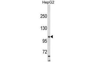 Western Blotting (WB) image for anti-Adaptor-Related Protein Complex 2, alpha 2 Subunit (AP2A2) (Middle Region) antibody (ABIN453516)