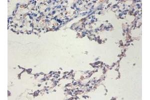 Immunohistochemistry of paraffin-embedded human lung tissue using ABIN7171713 at dilution of 1:100 (TERT Antikörper  (AA 281-436))