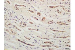 Formalin-fixed and paraffin embedded human kidney labeled with Rabbit Anti-YES1 Polyclonal Antibody, Unconjugated  at 1:200 followed by conjugation to the secondary antibody and DAB staining (YES1 Antikörper  (AA 441-541))