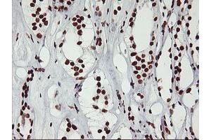 Immunohistochemical staining of paraffin-embedded Human Kidney tissue using anti-GSTT2 mouse monoclonal antibody. (GSTT2 Antikörper)