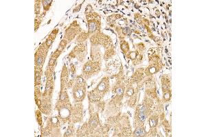 Immunohistochemistry of paraffin-embedded mouse testis using CD47 Rabbit pAb (ABIN3022623, ABIN3022624, ABIN3022625, ABIN1512716 and ABIN6218964) at dilution of 1:100 (40x lens). (CD47 Antikörper  (AA 20-140))