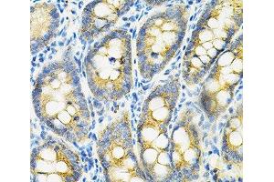 Immunohistochemistry of paraffin-embedded Rat intestine using HGF Polyclonal Antibody at dilution of 1:100 (40x lens). (HGF Antikörper)