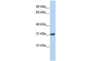 WB Suggested Anti-ZFAND3 Antibody Titration:  0. (ZFAND3 Antikörper  (Middle Region))