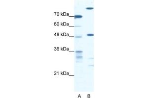 Western Blotting (WB) image for anti-NFS1, Cysteine Desulfurase (NFS1) antibody (ABIN2460657) (NFS1 Antikörper)