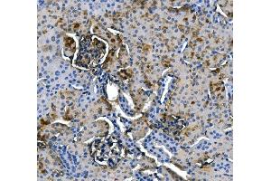 IHC analysis of ASS1 using anti-ASS1 antibody (ABIN7601191). (ASS1 Antikörper  (AA 3-365))