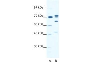 Western Blotting (WB) image for anti-DEAD (Asp-Glu-Ala-Asp) Box Polypeptide 21 (DDX21) antibody (ABIN2461343) (DDX21 Antikörper)