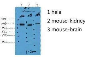 Western Blot (WB) analysis of 1) HeLa, 2) Mouse Kidney, 3) Mouse Brain, diluted at 1:2000.