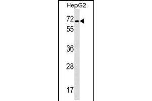 Western blot analysis in HepG2 cell line lysates (35ug/lane). (CACNB1 Antikörper  (C-Term))