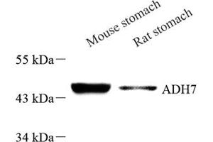 Western blot analysis of ADH7 (ABIN7072995) at dilution of 1: 500 (ADH7 Antikörper)