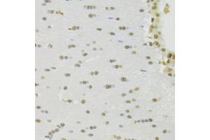 Immunohistochemistry of paraffin-embedded rat brain using RBPJ Antibody (ABIN1876876) at dilution of 1:100 (40x lens). (RBPJ Antikörper)