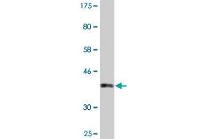 Western Blot detection against Immunogen (37. (PCSK2 Antikörper  (AA 501-609))