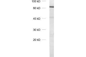 dilution: 1 : 1000, sample: olfactory bulb homogenate (Tyrosine Hydroxylase Antikörper)