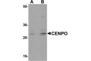 Western blot analysis of CENPO in mouse kidney tissue lysate with AP30224PU-N CENPO antibody at (A) 1 and (B) 2 μg/ml. (CENPO Antikörper  (Center))