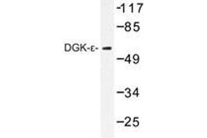 Western blot analysis of DGK-ε antibody in extracts from K562 cells.