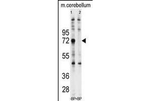 Western blot analysis of pre-incubated with and without blocking peptide in Jurkat cell line lysate (Ubiquilin 1 Antikörper  (N-Term))