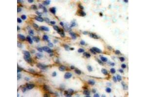 Used in DAB staining on fromalin fixed paraffin-embedded Spleen tissue (P-Selectin Antikörper  (AA 58-195))