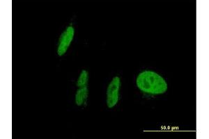 Immunofluorescence of purified MaxPab antibody to NR1I2 on HepG2 cell. (NR1I2 Antikörper  (AA 1-434))