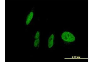 Immunofluorescence of purified MaxPab antibody to NR1I2 on HepG2 cell.