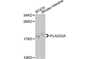 Western blot analysis of extracts of various cell lines, using PLA2G2A antibody. (PLA2G2A Antikörper)