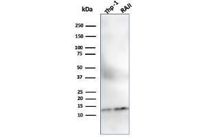 Western Blot Analysis of THP-1 and Raji Cell lysate using Beta-2-Microglobulin MAb (SPM617). (beta-2 Microglobulin Antikörper)