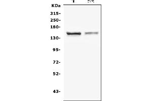 Western blot analysis of CRB1 using anti-CRB1 antibody (ABIN6719658).