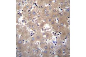 Formalin fixed, paraffin embedded human liver tissue stained with SIX5 Antibody  followed by peroxidase conjugation of the secondary antibody and DAB staining. (Six5 Antikörper  (Middle Region))