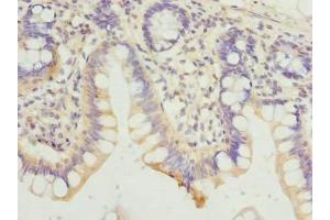 Immunohistochemistry of paraffin-embedded human small intestine tissue using ABIN7154822 at dilution of 1:100 (HDHD3 Antikörper  (AA 1-251))