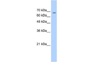 WB Suggested Anti-GP1BA Antibody Titration:  0.