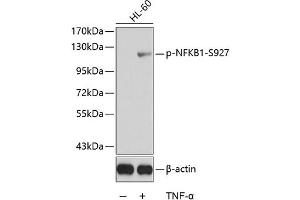 Western blot analysis of extracts from HL60 cells using Phospho-NFKB1-S927 antibody (ABIN3019967, ABIN3019968, ABIN3019969 and ABIN6225499). (NFKB1 Antikörper  (pSer927))