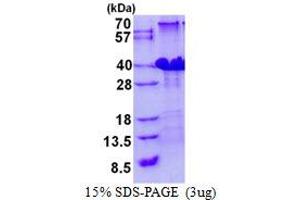 Polymerase (RNA) III (DNA Directed) Polypeptide H (22.9kD) (POLR3H) protein (His tag)