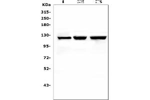 Western blot analysis of NLRP2 using anti-NLRP2 antibody (ABIN6719345). (NLRP2 Antikörper  (AA 9-190))